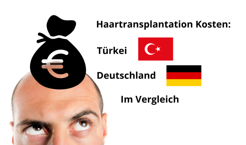 Haartransplantation Kosten: Türkei und Deutschland im Vergleich